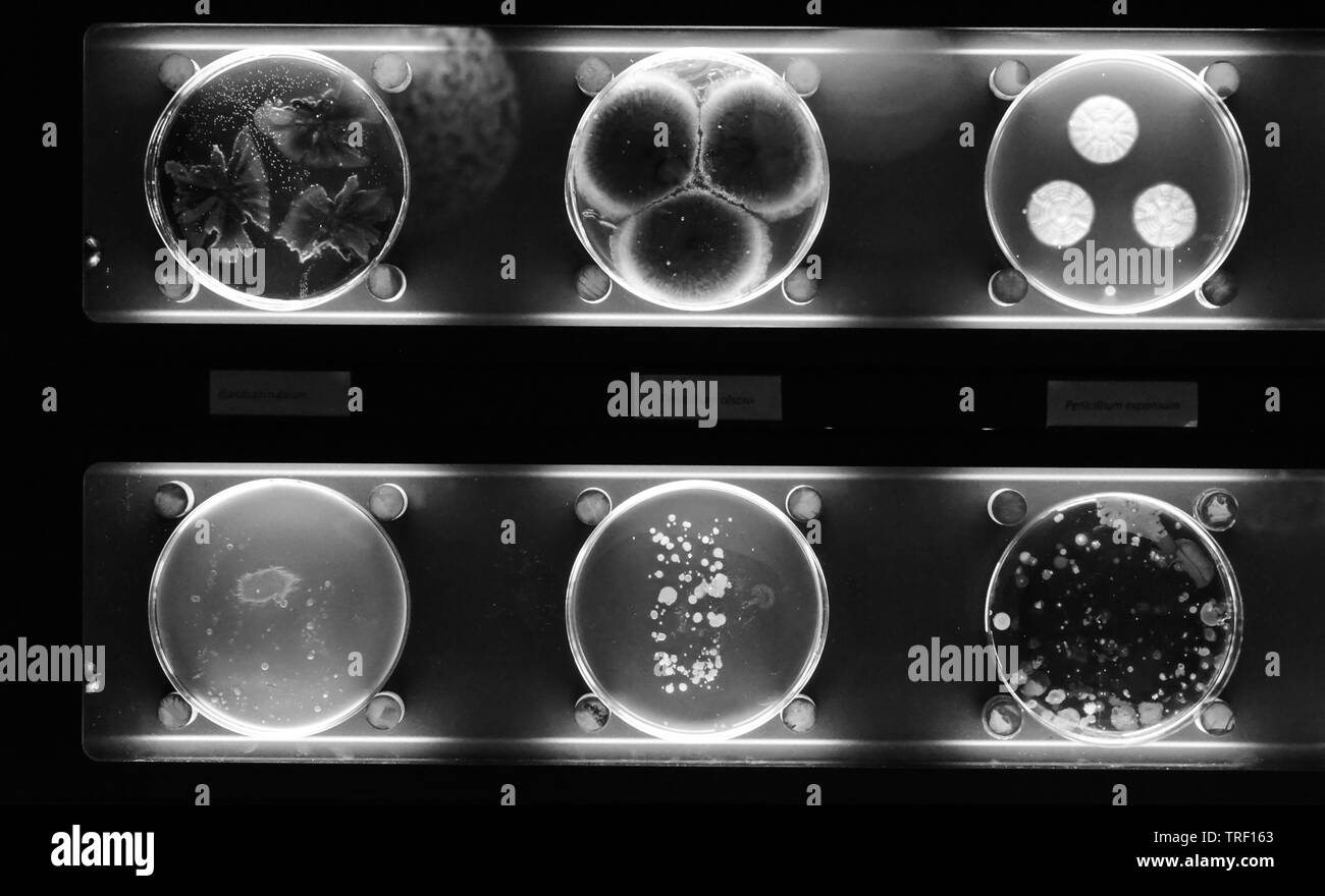 Verschiedene Proben mit Arten von Bakterien leben im gemeinsamen Haushalt Einzelteile. Schwarz und Weiß. Stockfoto
