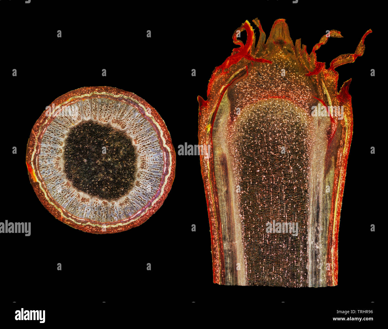 Sycamore Stammzellen & Bud, TS & LS. Acer pseudoplatanus, ein Jahr alt. Darkfield Ablichtung. Stockfoto
