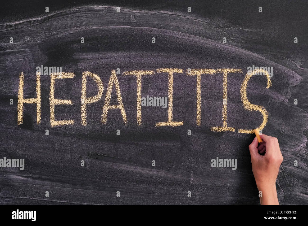 Person schreiben das Wort Hepatitis auf einer Tafel. Close Up. Stockfoto