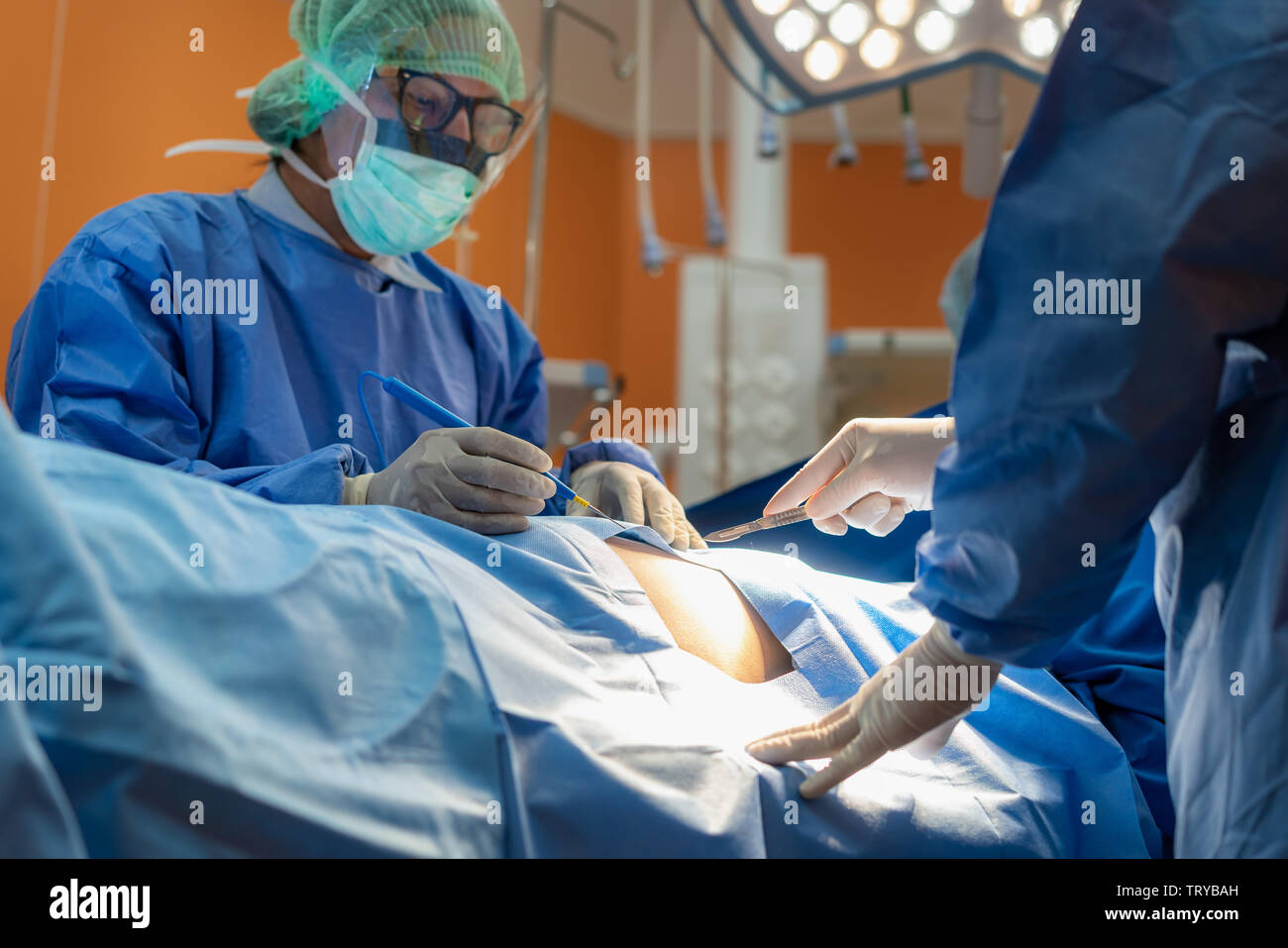 Gruppe von Chirurgen bei der Arbeit im Operationssaal. Medizinisches Team Ausführen des Vorgangs Stockfoto