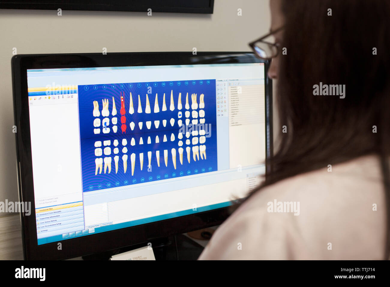 Arzt auf Zähne Diagramme auf Computer in der Medizinischen Klinik Stockfoto