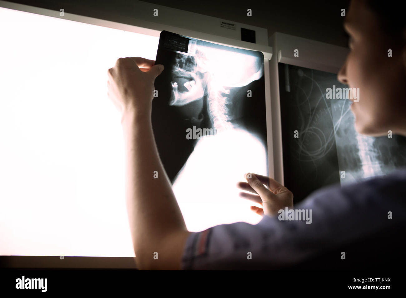 Ärztin untersuchen Hals x-ray auf Diagnostika Werkzeug Stockfoto