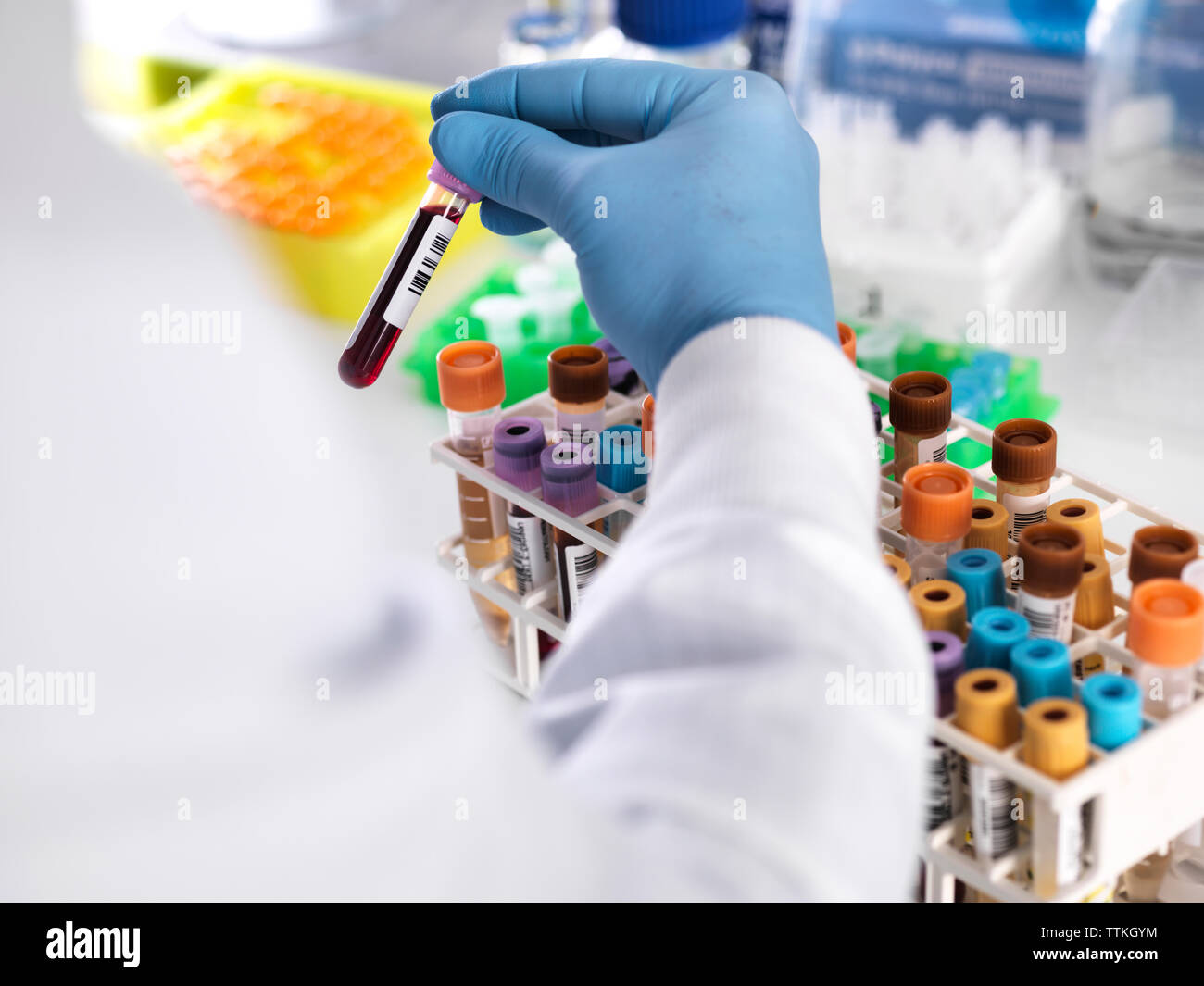 Nahaufnahme der Labortechniker holding Blutprobe für medizinische Prüfung Stockfoto
