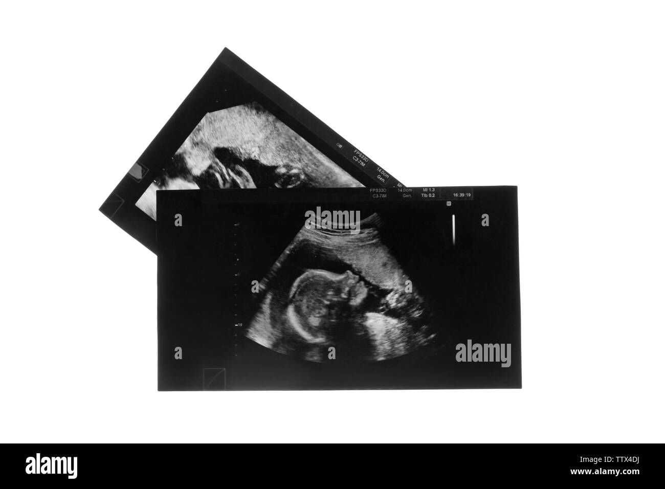 Ultraschall Bilder von Baby auf weißem Hintergrund Stockfoto