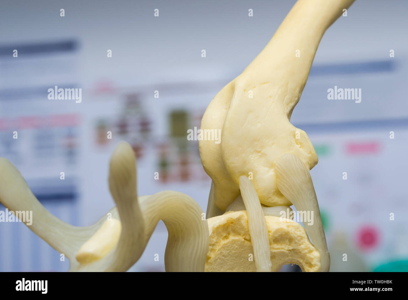 Seitlicher Meniskus Stockfotos und bilder Kaufen Alamy