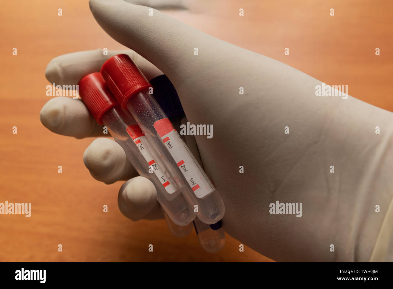 Pro-Koagulation Plain Clot Activator Blutentnahmeröhrchen, mit rotem Kunststoff Stopfen von Hand im Labor statt. Stockfoto