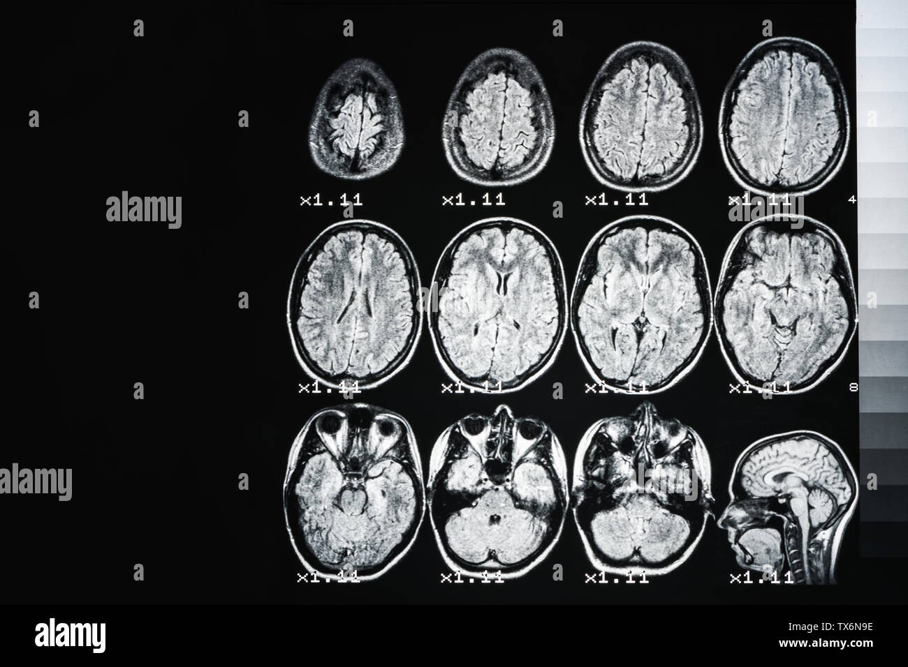Mrt des Gehirns einer gesunden Person auf einem schwarzen Hintergrund mit grau Hintergrundbeleuchtung. Medizinischer Hintergrund Stockfoto
