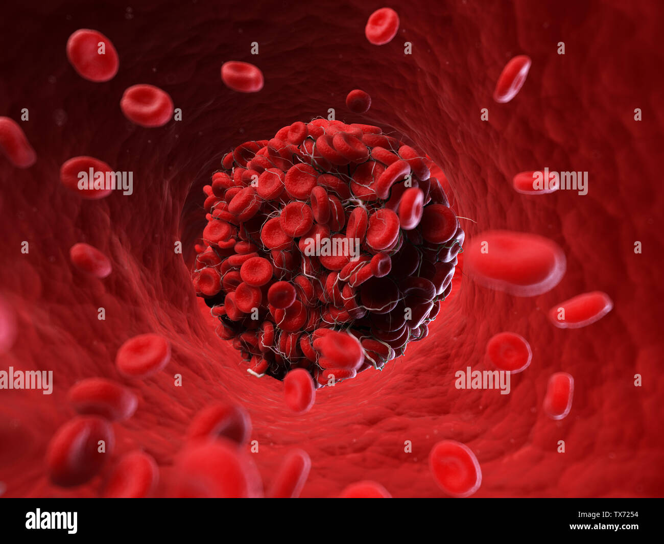 3D gerendert, medizinisch genaue Abbildung eines Blutgerinnsels Stockfoto