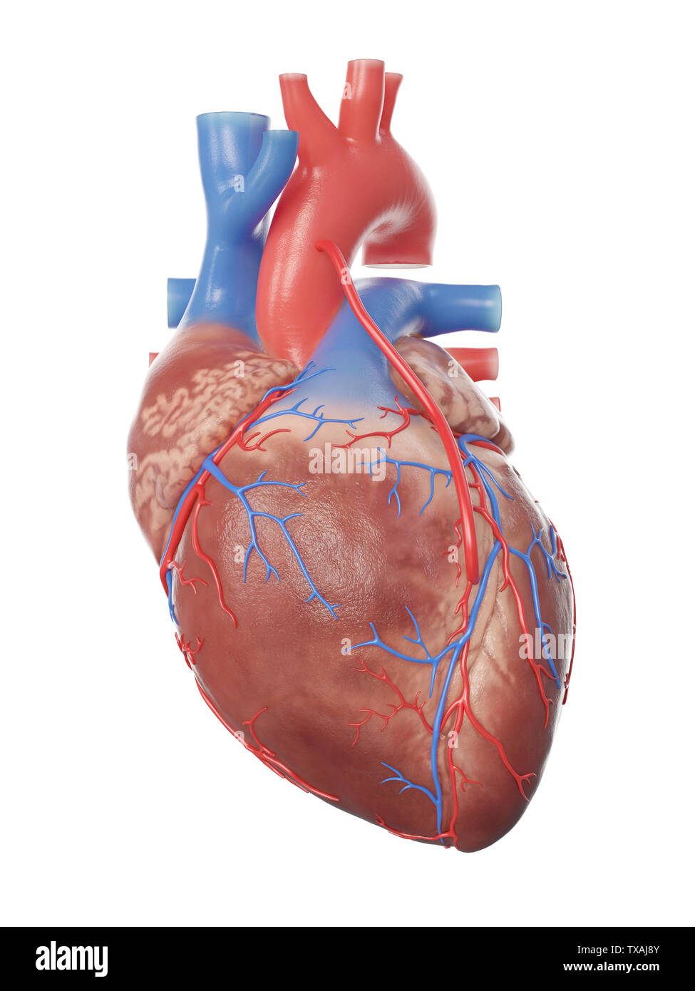 3D-gerenderte Medizinisch genaue Abbildung eines Herzens mit einem Bypass Stockfoto