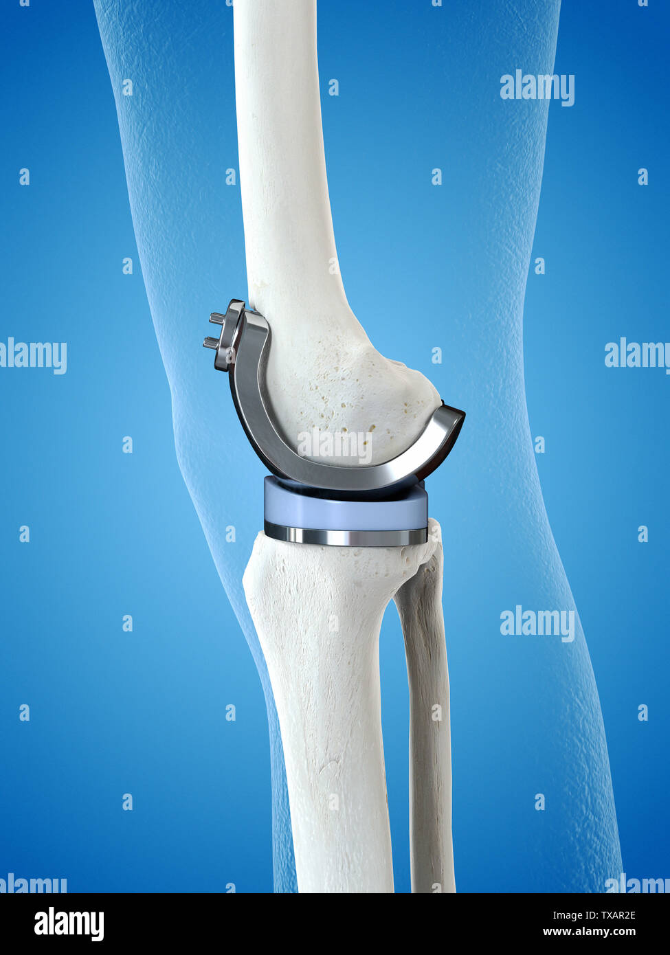 3D-gerenderte Medizinisch genaue Abbildung eines Kniegelenk Stockfoto