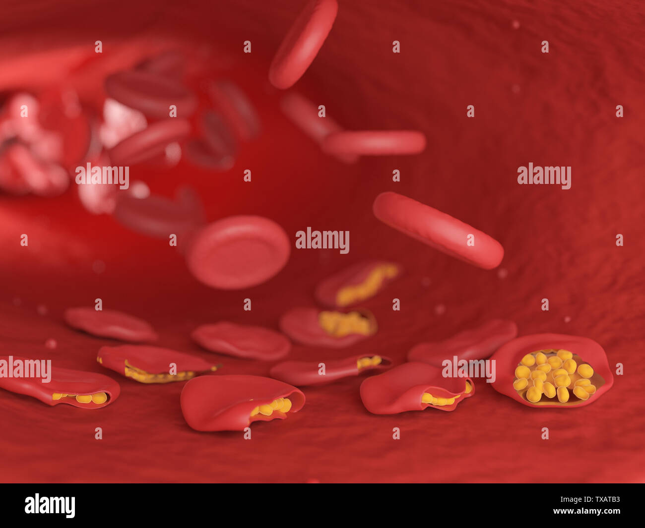 3D-gerenderte Abbildung von Malaria infizierten Blutzellen Stockfoto
