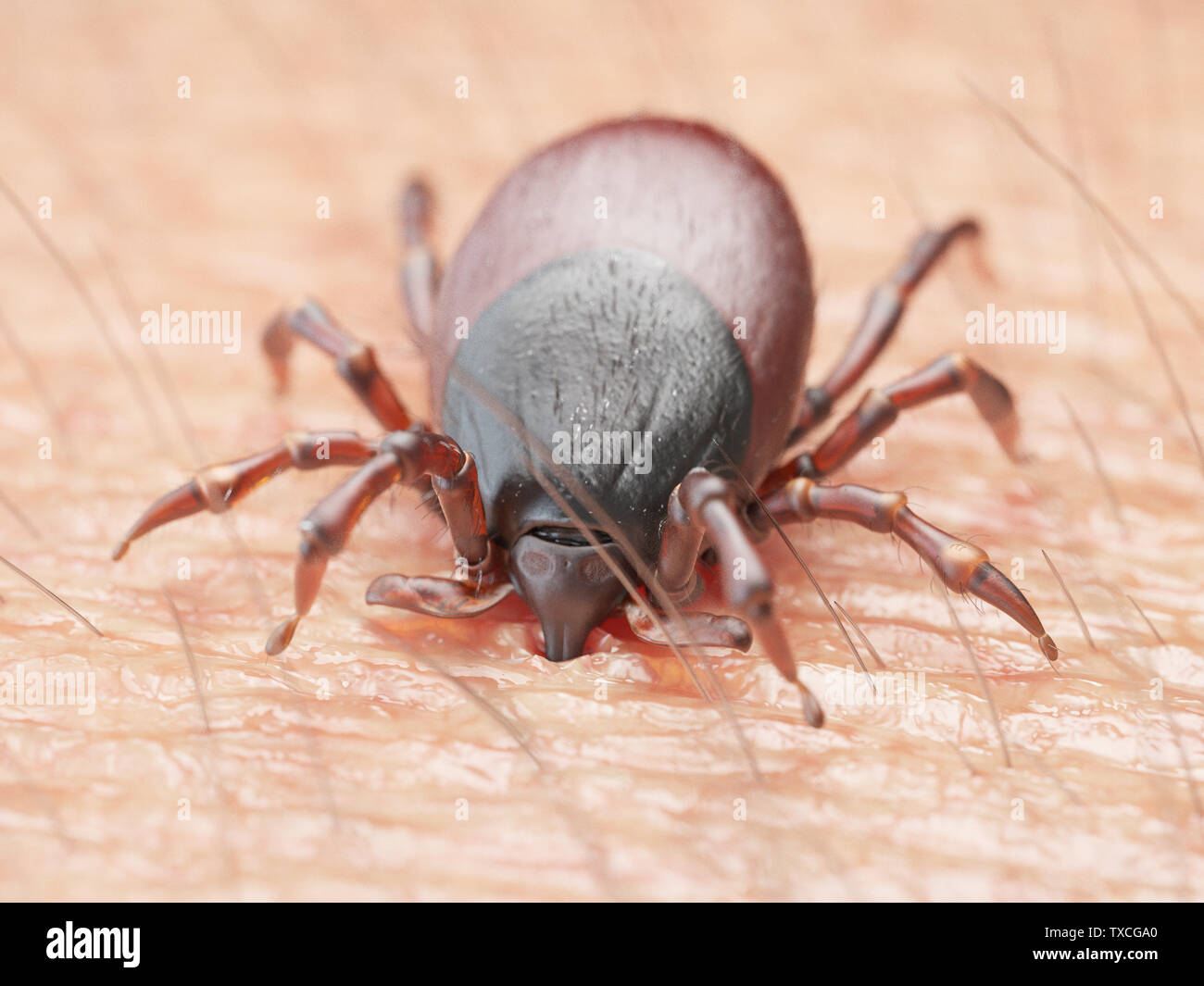 3D-gerenderte Abbildung: die Zecke in die menschliche Haut beißen Stockfoto