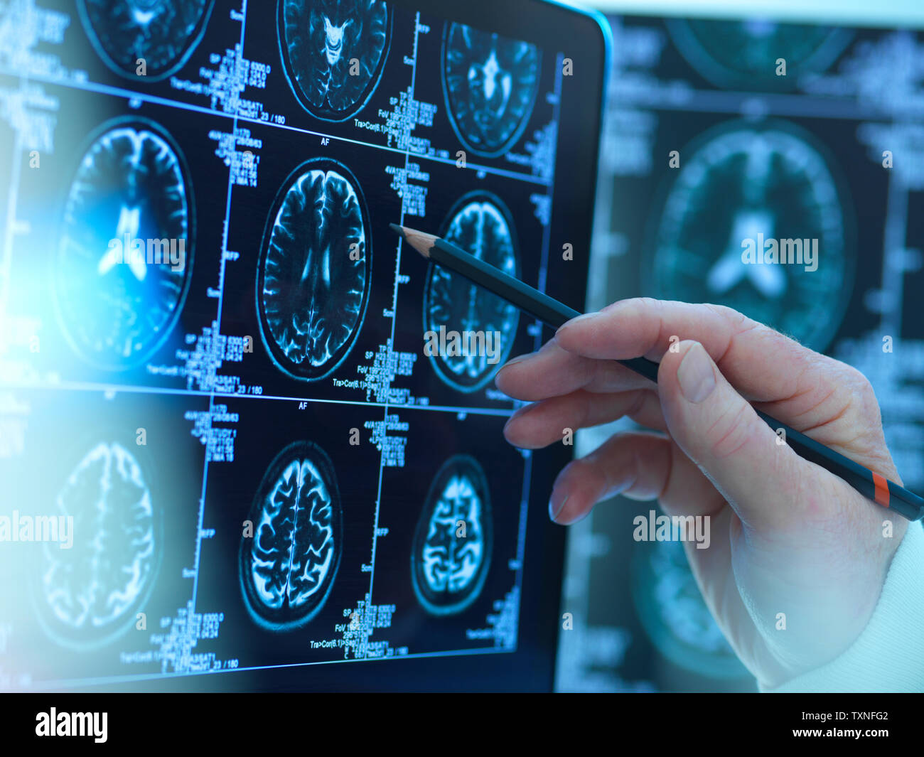 Arzt anzeigen Scans des Gehirns für mögliche Krankheit oder Schaden in Klinik Stockfoto