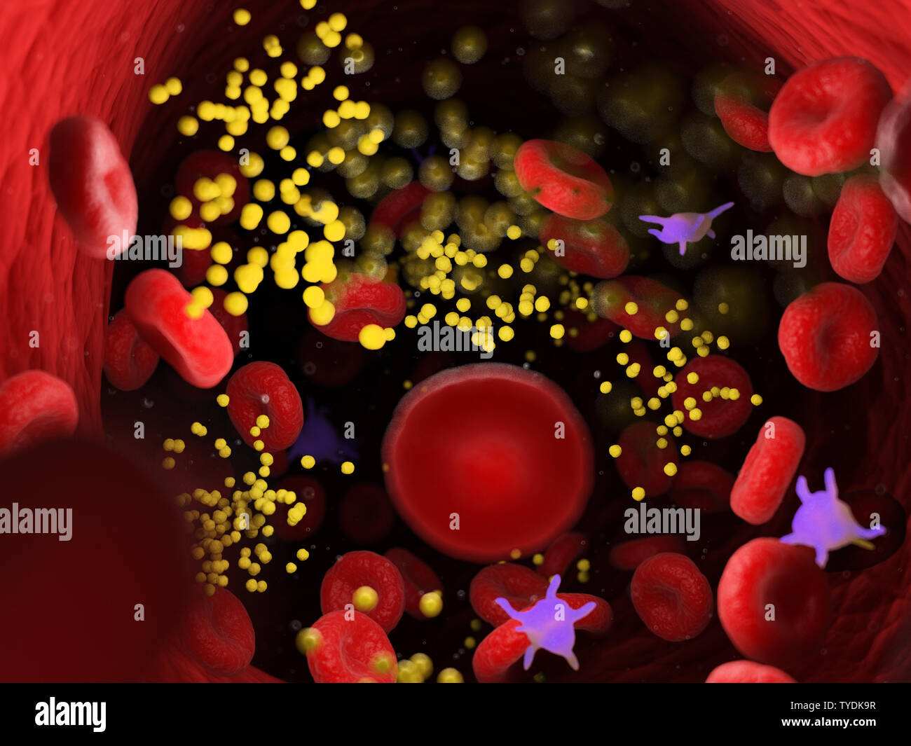 3D-gerenderte Medizinisch genaue Abbildung von Fett in den Blutfluss Stockfoto
