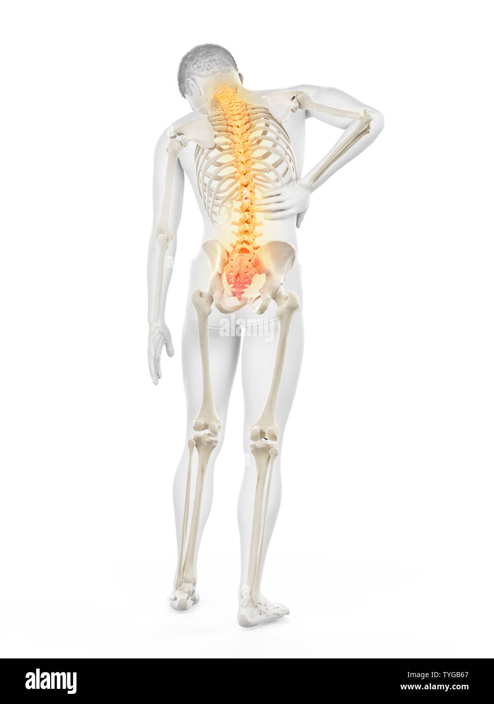 3D-gerenderte Medizinisch genaue Abbildung eines Mans schmerzhaft zurück Stockfoto