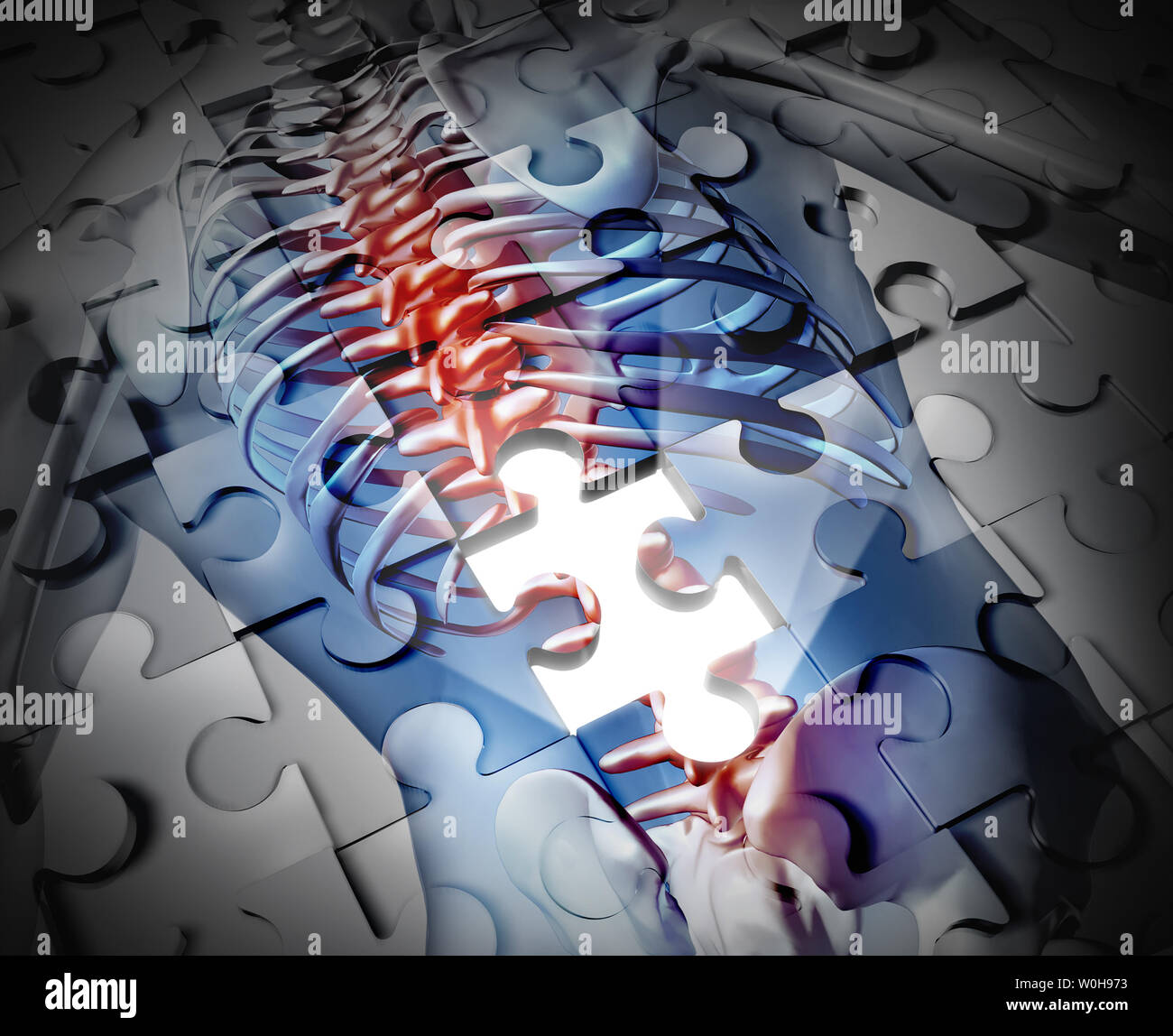 Physiotherapie und Rehabilitation Rückenschmerzen Schmerz als eine physikalische Therapie Konzept in einer 3D-Darstellung. Stockfoto