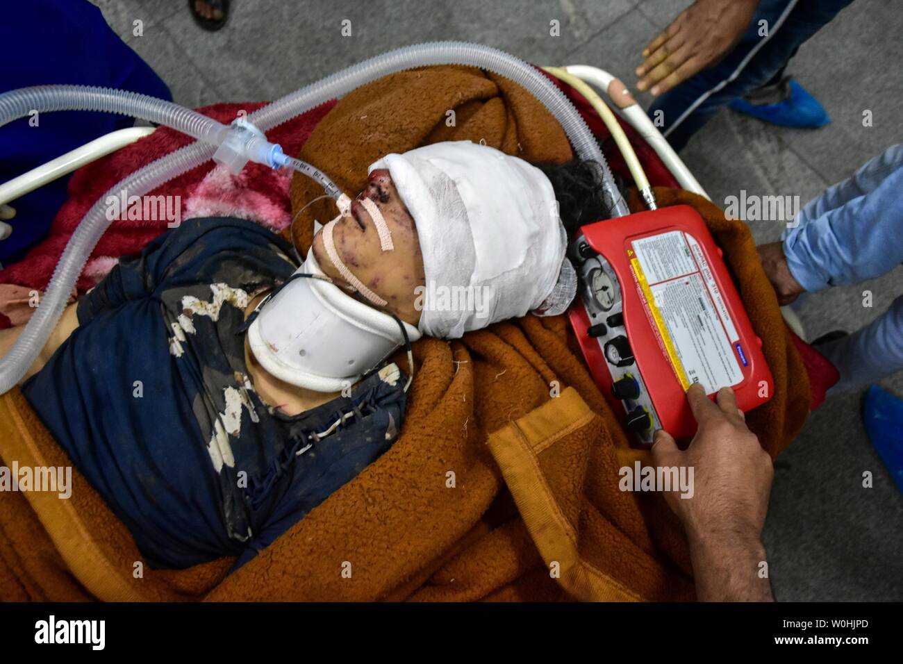 (Anmerkung des Editors: Image enthält grafische Inhalte.) Eine verletzte Schüler ist eine Behandlung in einem örtlichen Krankenhaus gesehen nach einem Busunfall in Srinagar. Elf Schüler, darunter neun Mädchen, bei einem Unfall nach dem Ausflug mit dem Bus sie in fiel in eine tiefe Schlucht bei Peer ki Gali, einem Pass auf dem historischen Mughal Straße im Stadtteil Shopian Kaschmir Reisen wurden getötet. Sieben Personen bei dem Unfall verletzt worden und haben zu einem lokalen Krankenhaus in Srinagar, die für die Behandlung verschoben, Beamte. Stockfoto