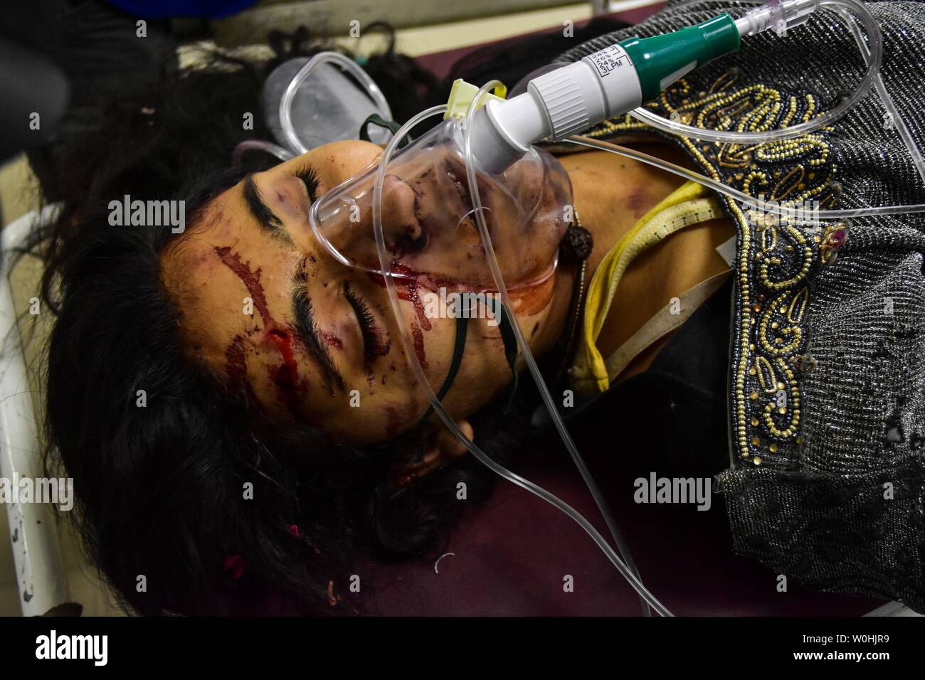 (Anmerkung des Editors: Image enthält grafische Inhalte.) Eine verletzte Frau gesehen wird, eine Behandlung in einem örtlichen Krankenhaus nach einem Busunfall in Srinagar. Elf Schüler, darunter neun Mädchen, bei einem Unfall nach dem Ausflug mit dem Bus sie in fiel in eine tiefe Schlucht bei Peer ki Gali, einem Pass auf dem historischen Mughal Straße im Stadtteil Shopian Kaschmir Reisen wurden getötet. Sieben Personen bei dem Unfall verletzt worden und haben zu einem lokalen Krankenhaus in Srinagar, die für die Behandlung verschoben, Beamte. Stockfoto