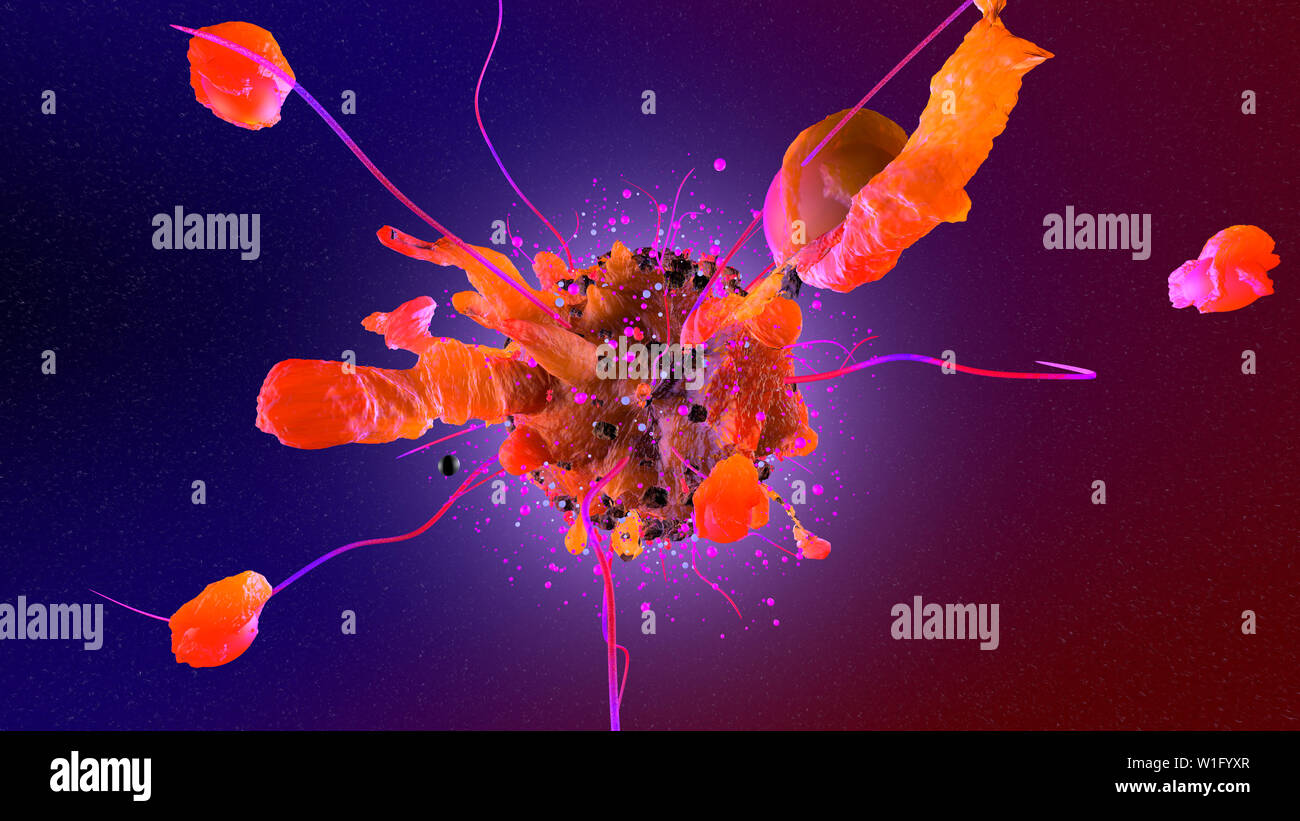 Verschleppung Von Krebszellen Durch Biopsie www.alamy.de