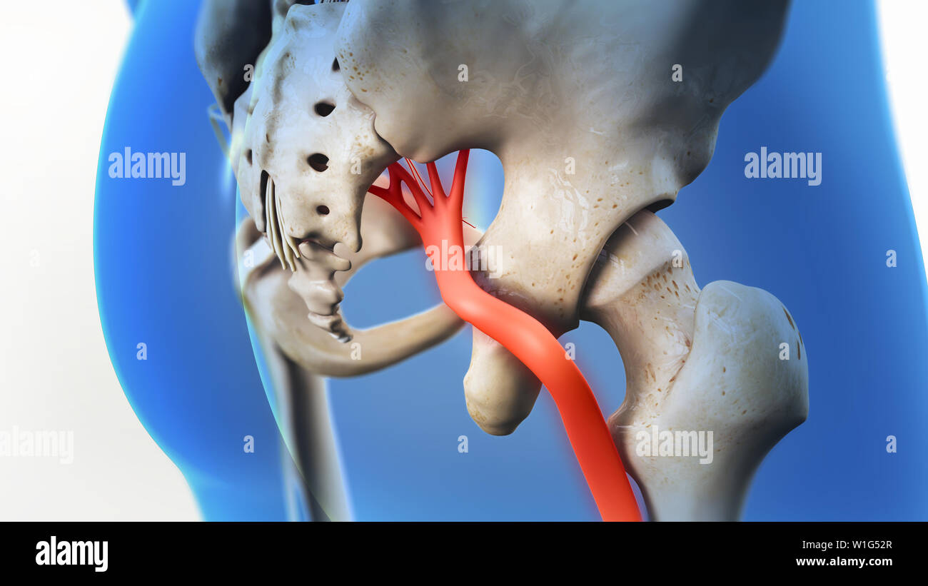 Ischiasnerv Schmerz 3D-Darstellung Stockfoto