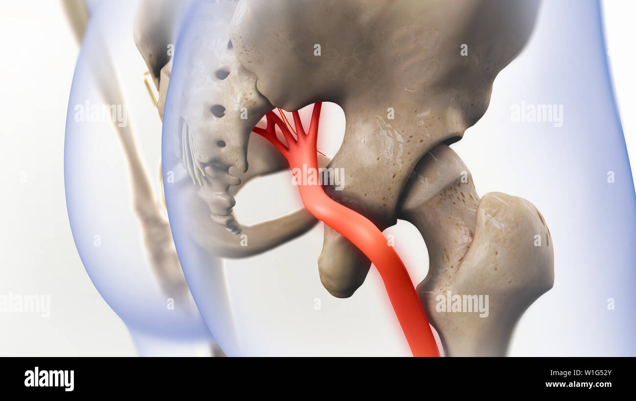 Ischiasnerv Schmerz 3D-Darstellung Stockfoto