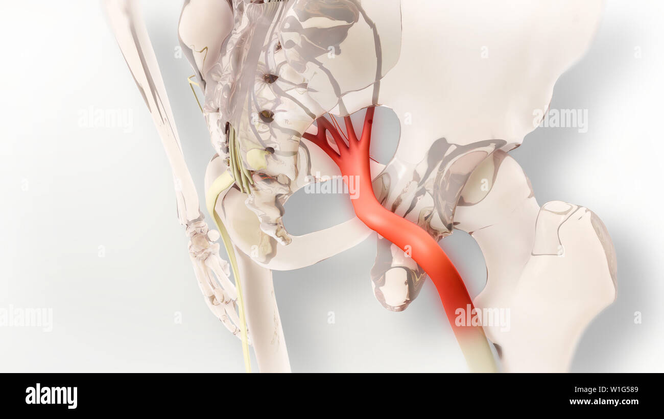 Ischiasnerv Schmerz 3D-Darstellung Stockfoto