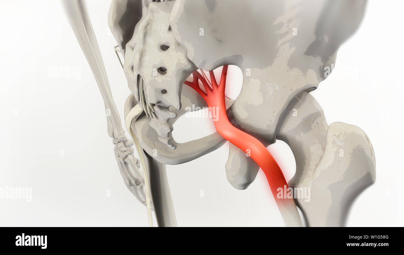 Ischiasnerv Schmerz 3D-Darstellung Stockfoto