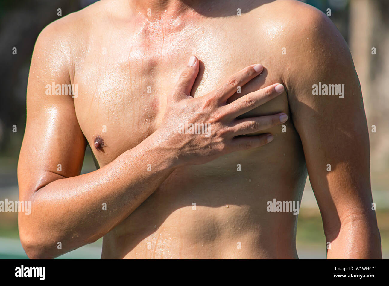 Die Handgriffe der Brust, die Entzündung von einer Sportverletzung. Stockfoto