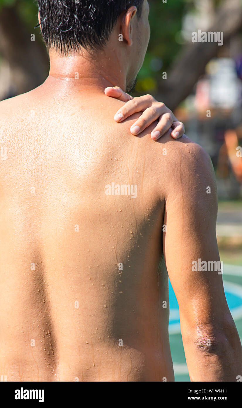 Die Handgriffe der Schulter, die Entzündung von einer Sportverletzung. Stockfoto