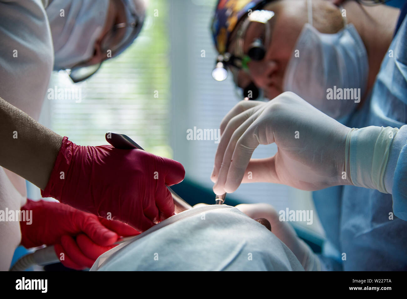 Die Hände der Chirurgen des Zahnarztes und der Assistent mit dem Instrument, das während der Operation. Stockfoto