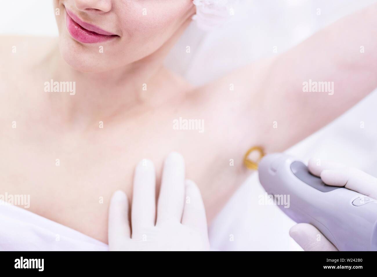Junge Frau erhält Elektrolyse Behandlung für unter die Arme. Stockfoto