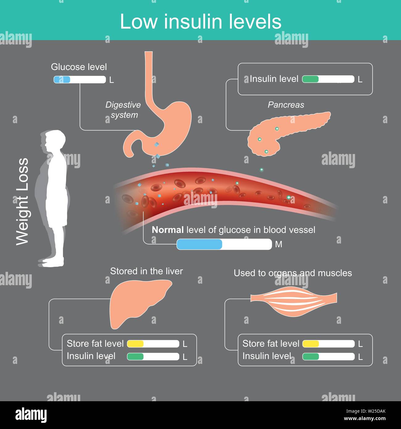 Niedrigen Insulinspiegel. Verringerung der Stärke und Zucker Zutat in Lebensmitteln wird in der Bauchspeicheldrüse sezernieren weniger Insulin, das Gehirn ist nicht die Förderung der Appe Stock Vektor