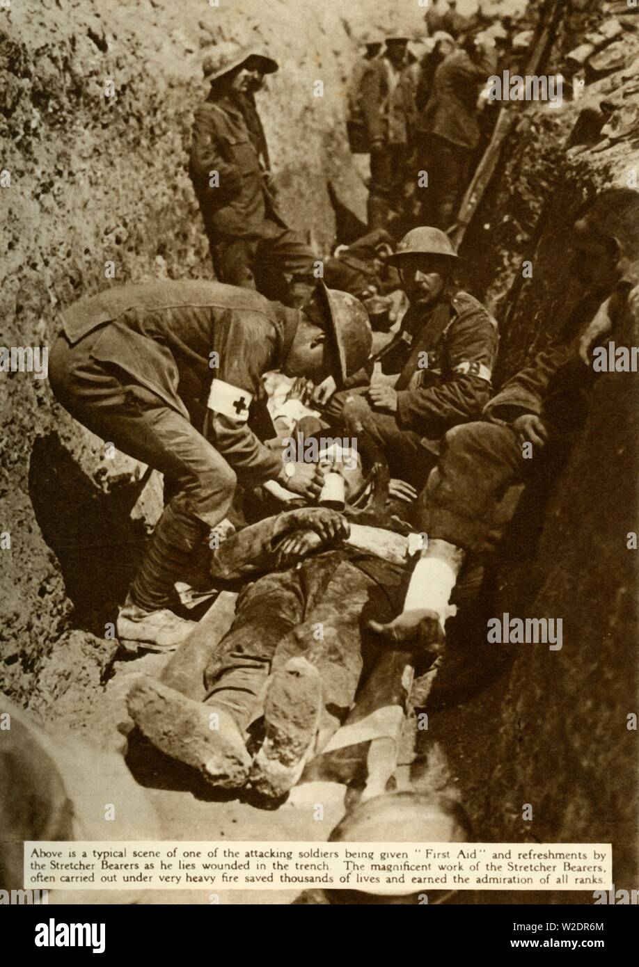 Verletzte Soldaten in den Schützengräben behandelt, Schlacht an der Somme, Erster Weltkrieg, 1916, (1935). Schöpfer: Unbekannt. Stockfoto