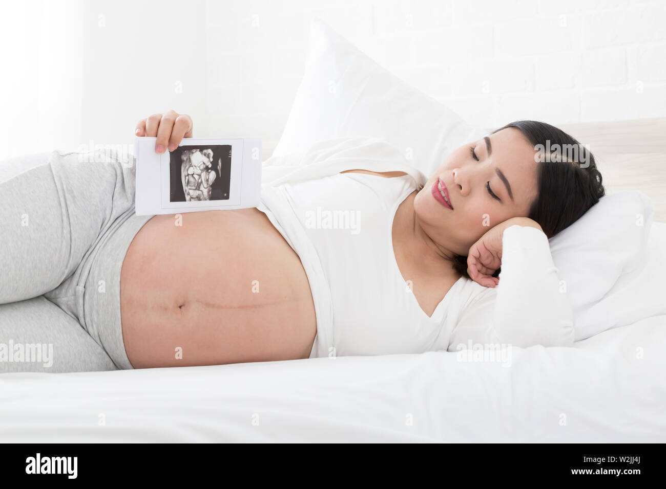 Schwangere Frauen liegen auf der linken Seite auf dem Bett und halten vier-dimensionalen Ultraschallbilder an Hand, Techniken und Abdominaldiagnostik, Pränatale diag Stockfoto