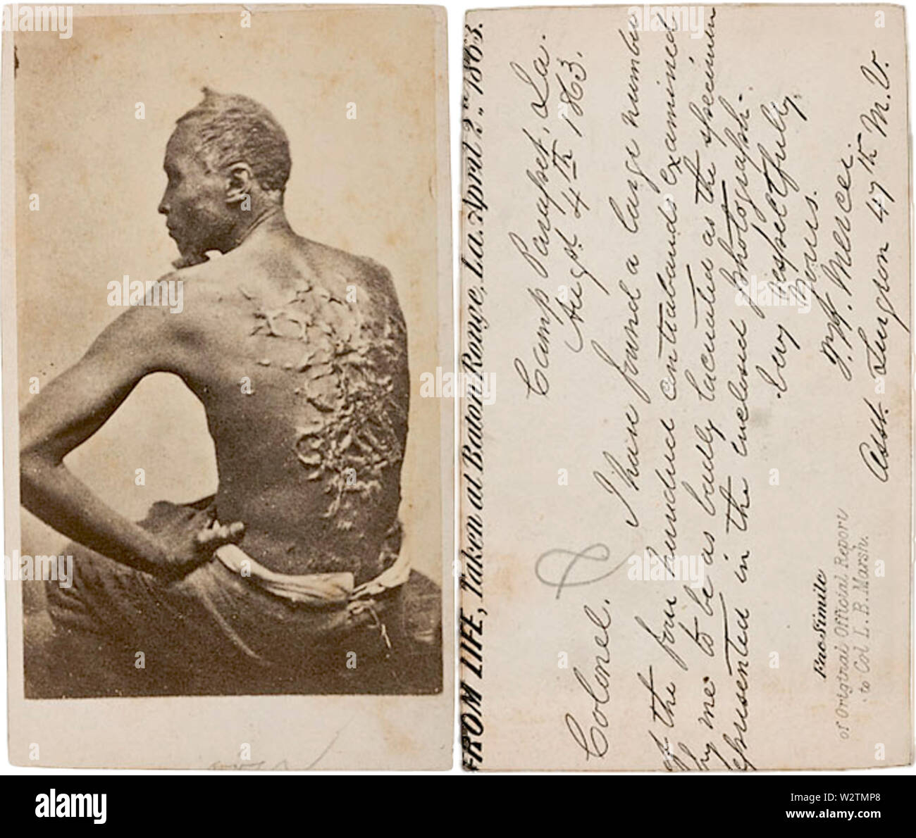 Escaped-Slave - Gordon - CDV - Porträt,-1863 Stockfoto