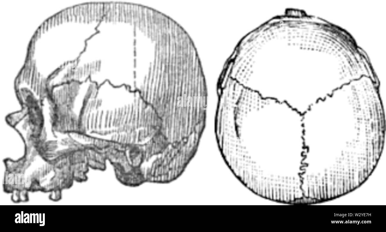 Hügelbauer American Indian mongoliden Schädel Stockfoto