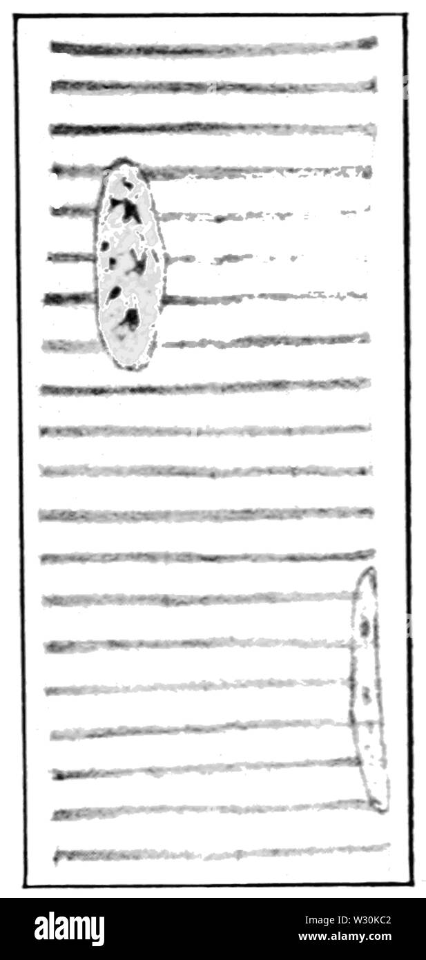 PSM V71 D117 Muskelfaser der menschlichen Zunge Stockfoto