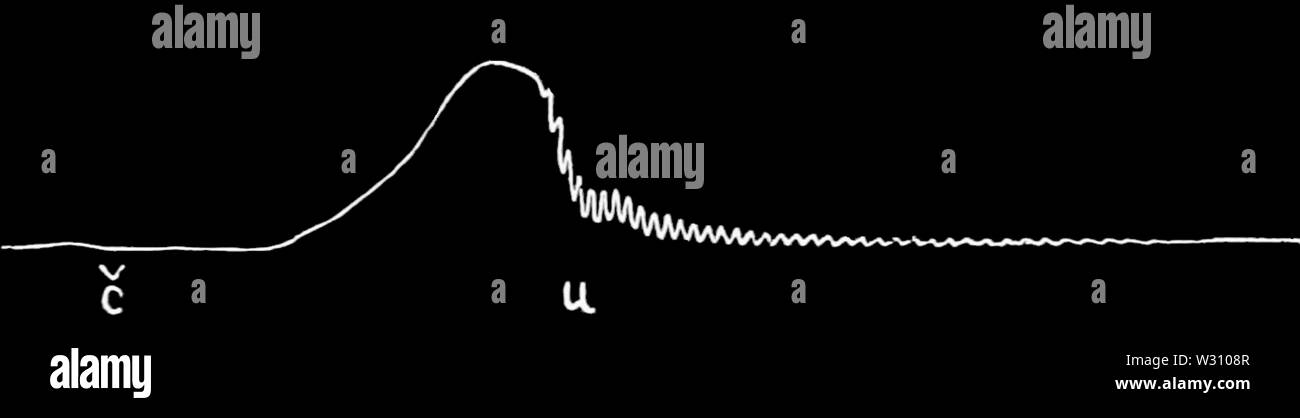 PSM V79 D 357-Aufnahme des Wortes kauen Stockfoto