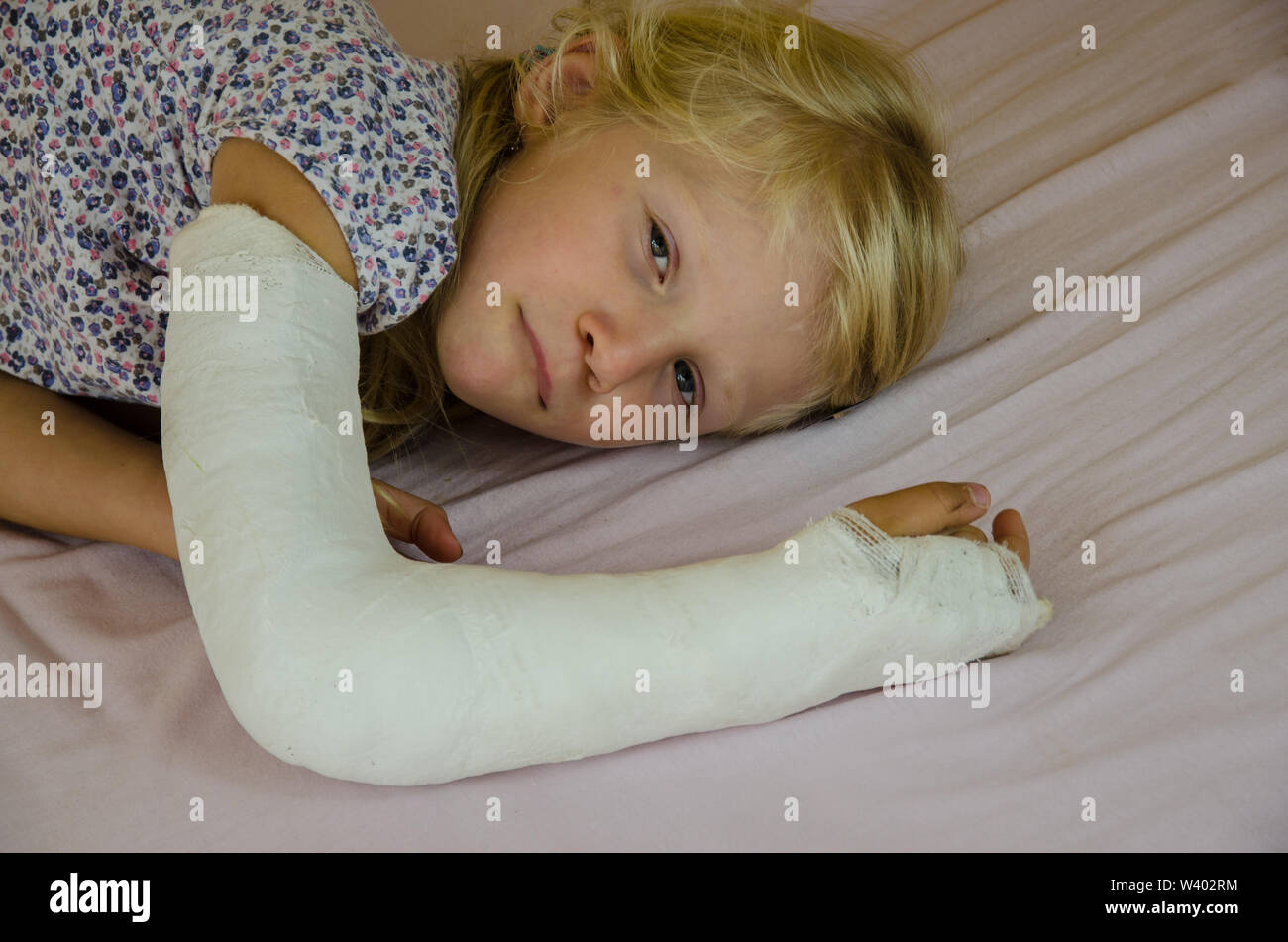 Blonde Mädchen mit gebrochenen Hand verletzt Stockfoto