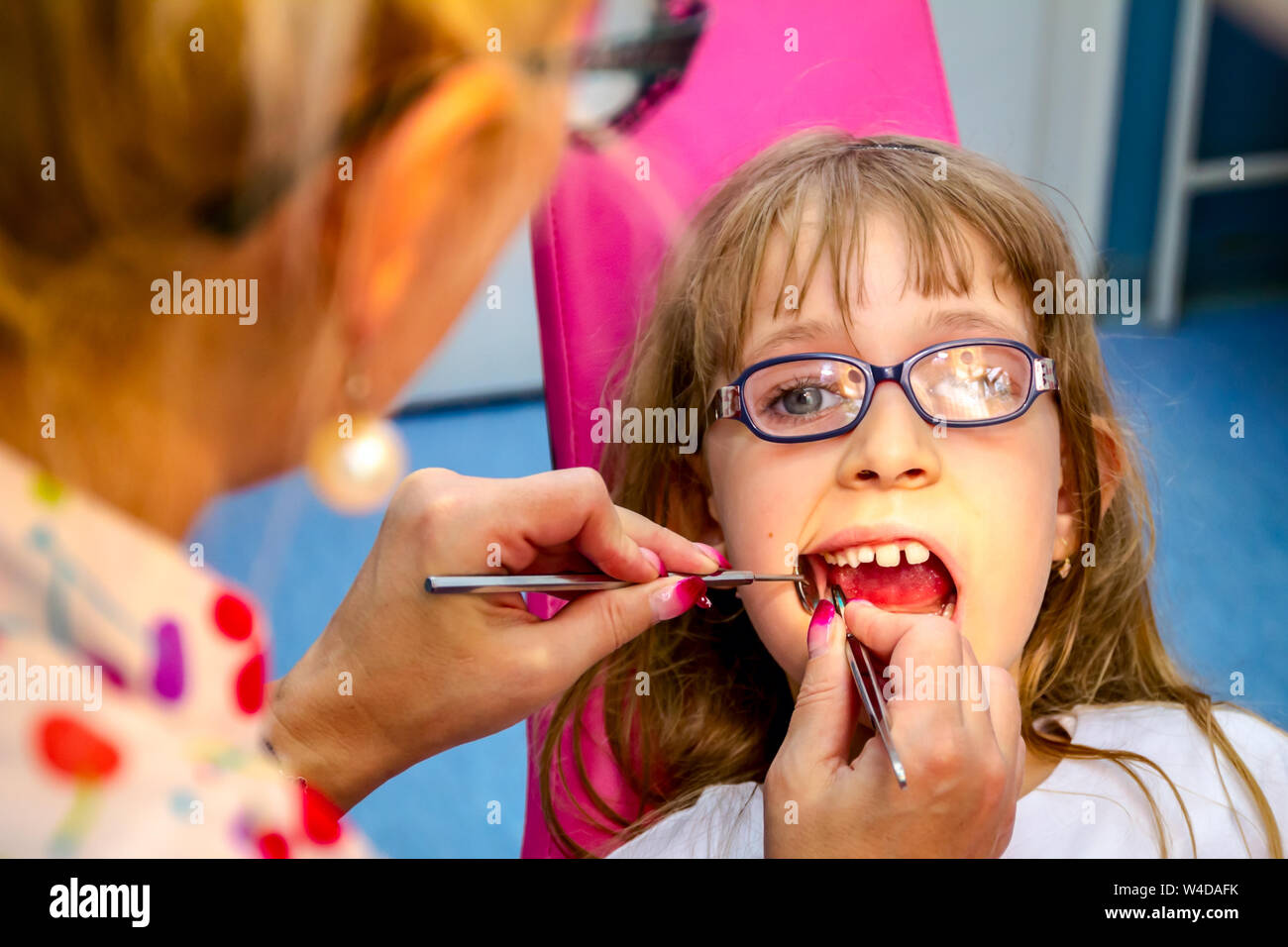 Portrait von süßen kleinen Mädchen mit offenen Mund, Gläser und unbeschwerten Ausdruck auf ihrem Gesicht während der zahnmedizinischen prüfen. Stockfoto