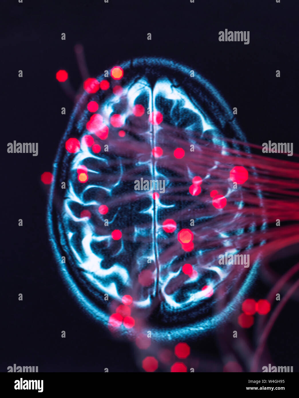 Neurowissenschaften, Fiber Optics, die Daten um das Gehirn Stockfoto