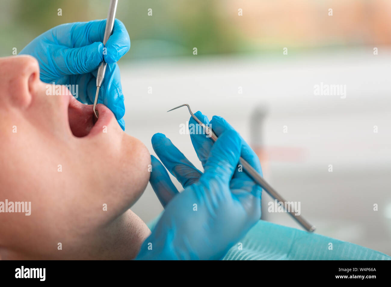 Eine weibliche Zahnarzt untersucht die Mundhöhle des Patienten mit einem Werkzeug mit einem Spiegel. Close-up Portrait von einem Patienten mit offenem Mund, ein Arzt in Stockfoto