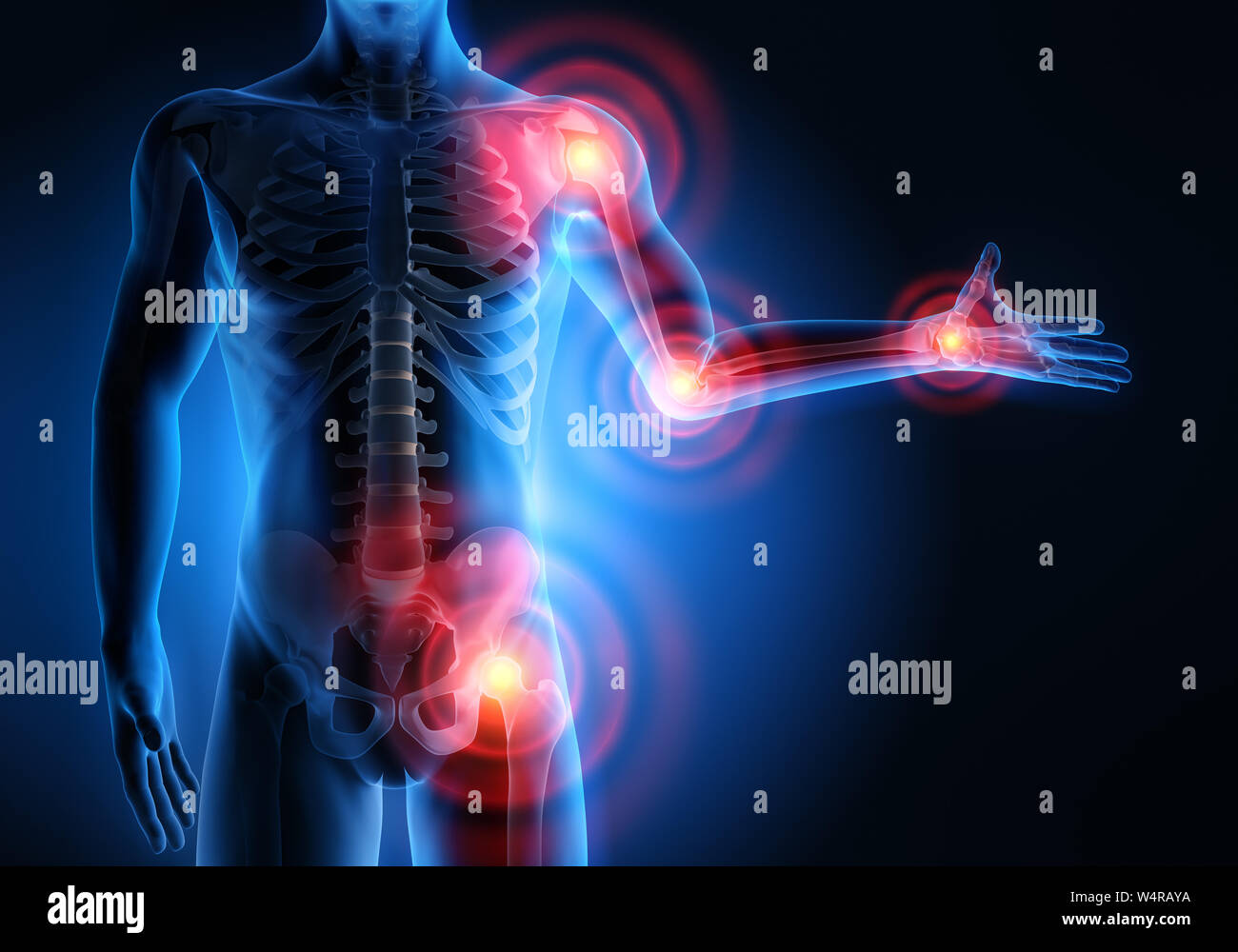Mann mit schmerzhaften Gelenken - 3D-Abbildung in x-ray Style Stockfoto