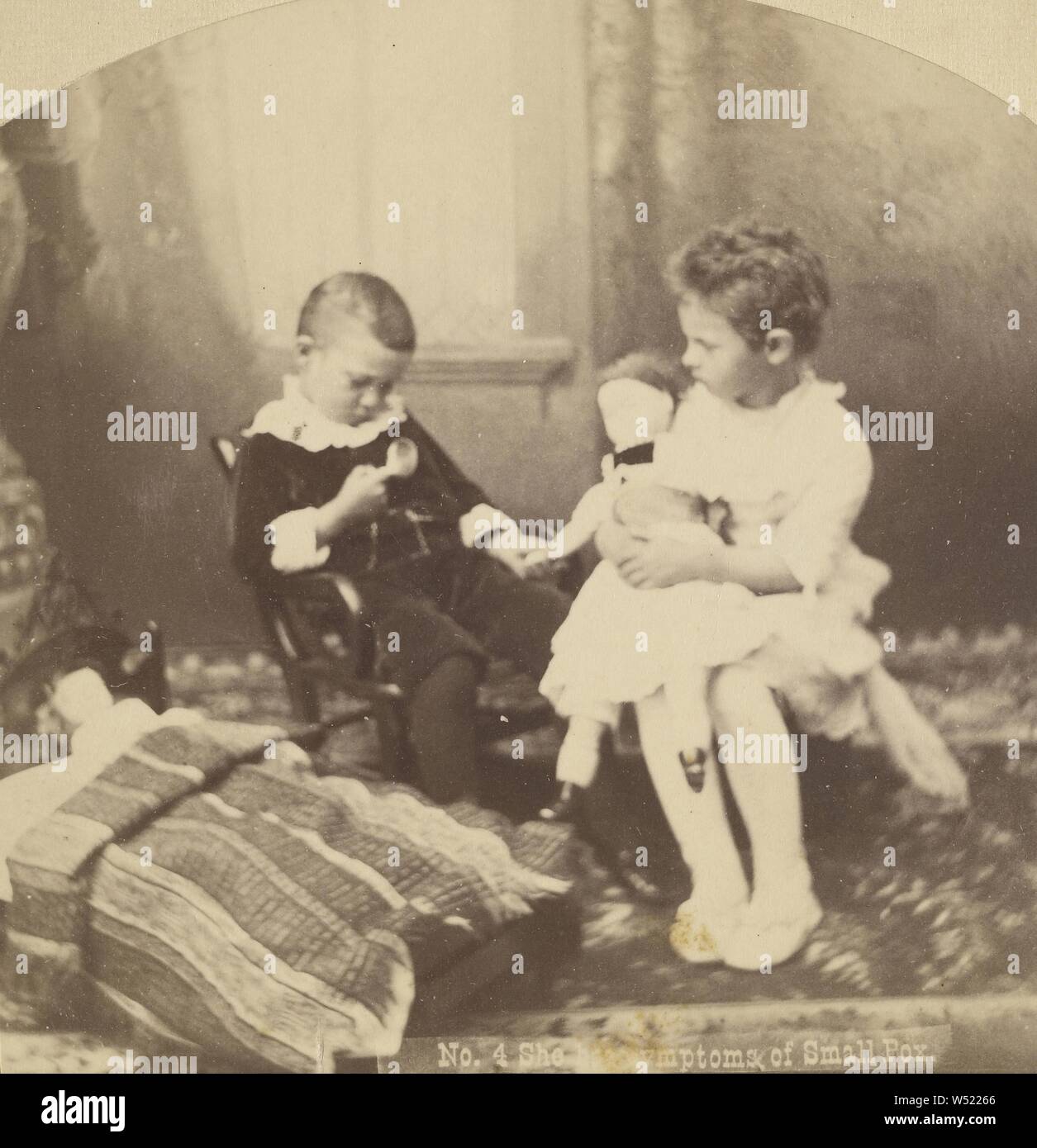 Sie hat die Symptome der Pocken., Edward und Henry T. Anthony & Co (American, 1862-1902), ca. 1870, Eiweiß silber Drucken Stockfoto