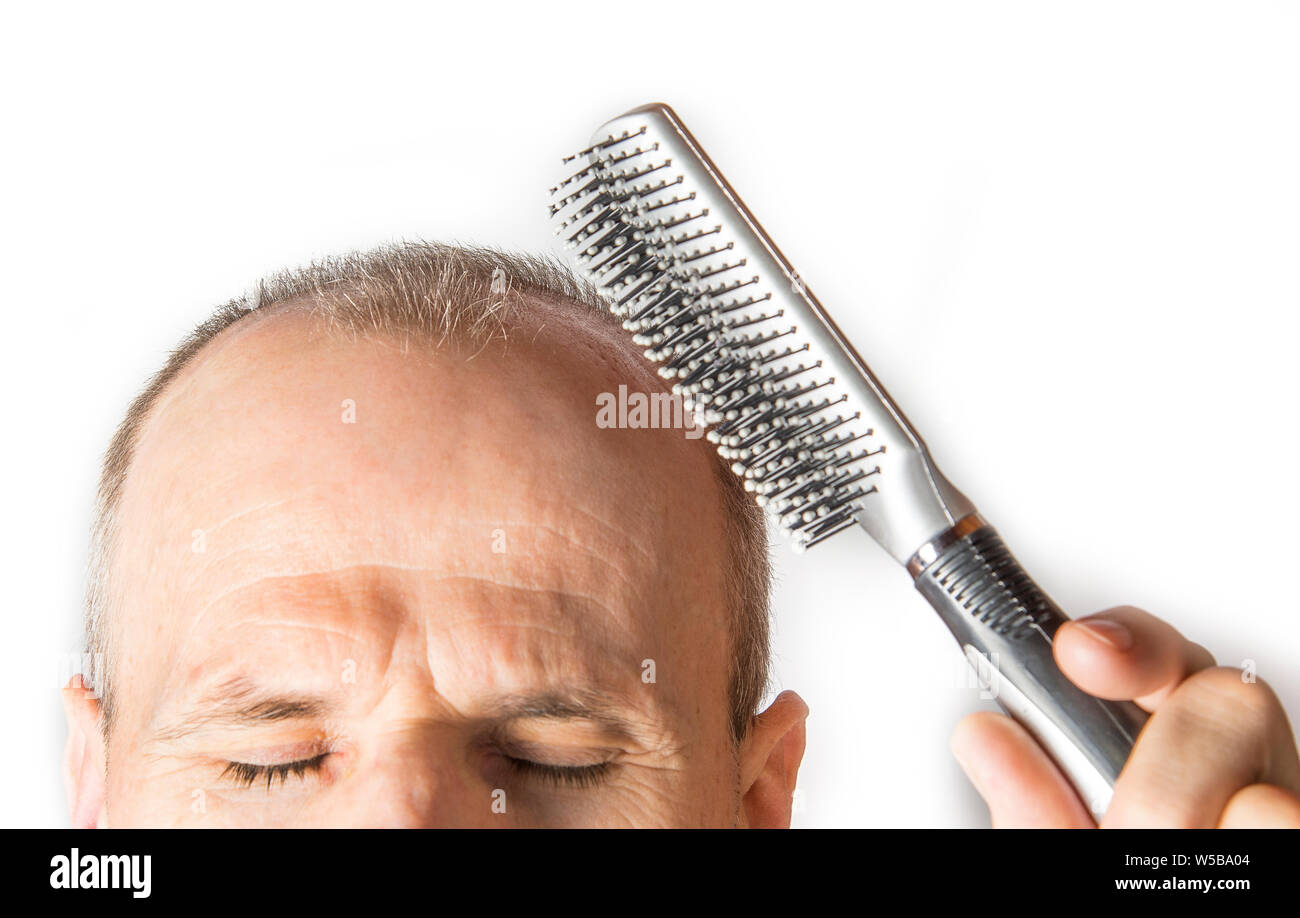 Glatzköpfige Mann mit Kamm. Haarausfall Konzept Stockfotografie - Alamy