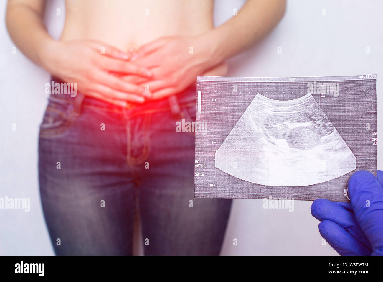 Chirurgie bei leistenbruch Fotos und Bildmaterial in hoher Auflösung Alamy