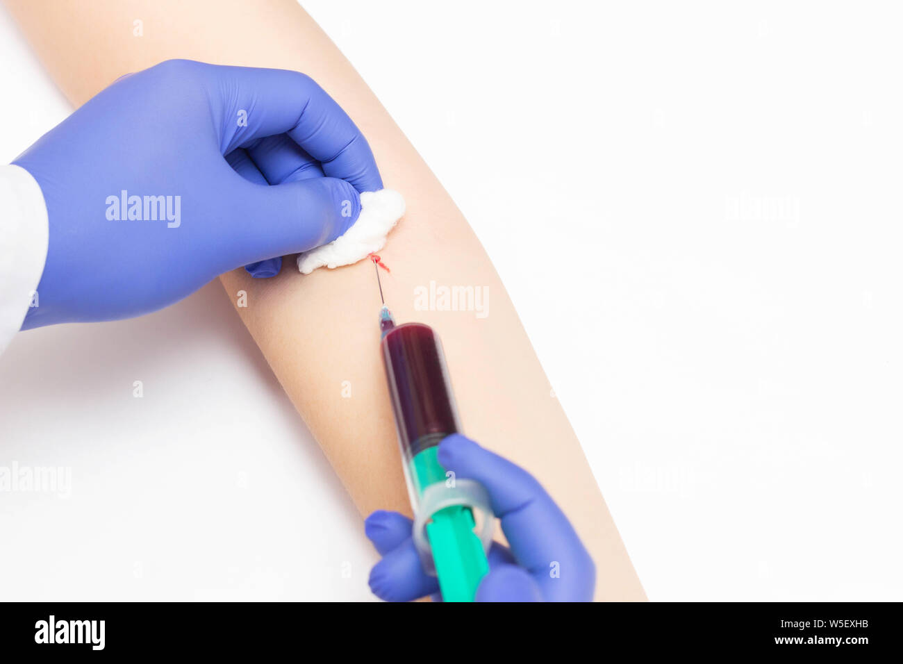 Nimmt der Arzt eine Blutprobe für die Studie der Schilddrüsenhormone und Autoimmunerkrankungen, Nahaufnahme, Kopie, Venerologie, prblem Stockfoto