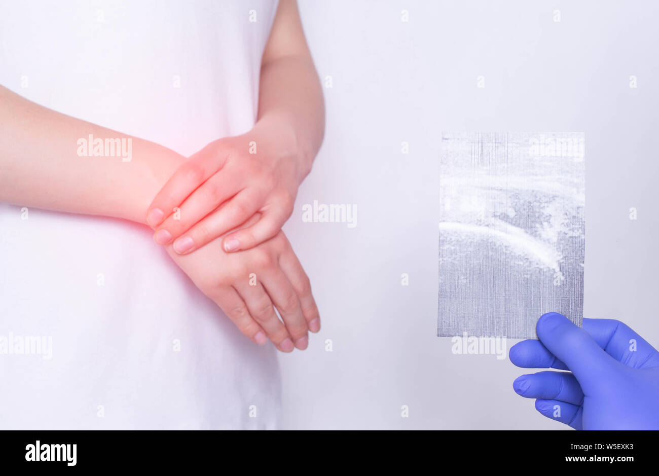 Ein Arzt untersucht einen Patienten mit einem Ultraschallbild, die Schmerzen und Entzündungen im Handgelenk, posttraumatische Polyarthritis, Morbus Bechterew Stockfoto