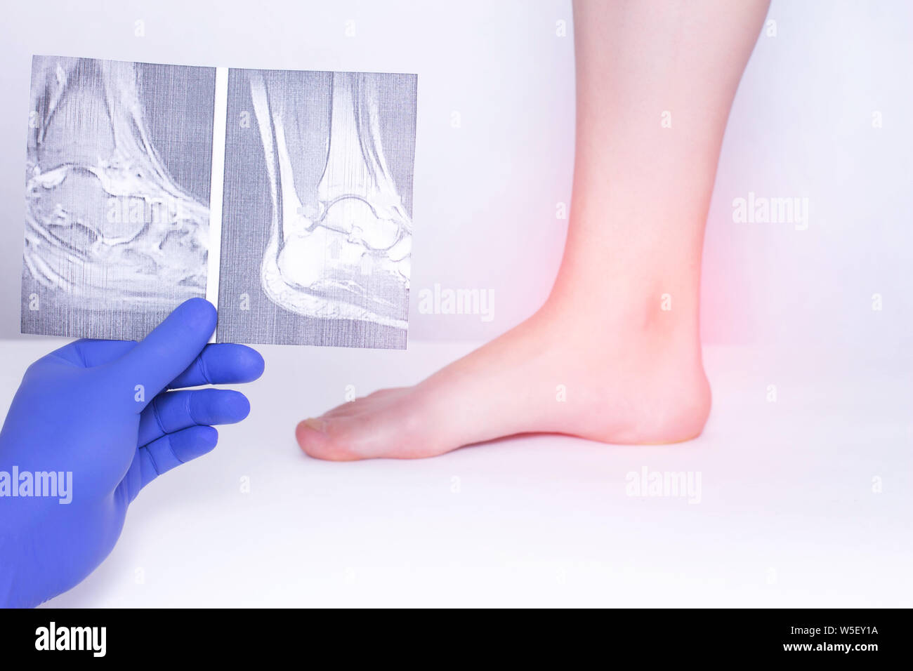 Der Arzt führt eine ärztliche Untersuchung des Fußgelenks mit Hilfe eines x-ray die Krankheit Arthrose, Diagnose zu erkennen, Bandapparat Stockfoto
