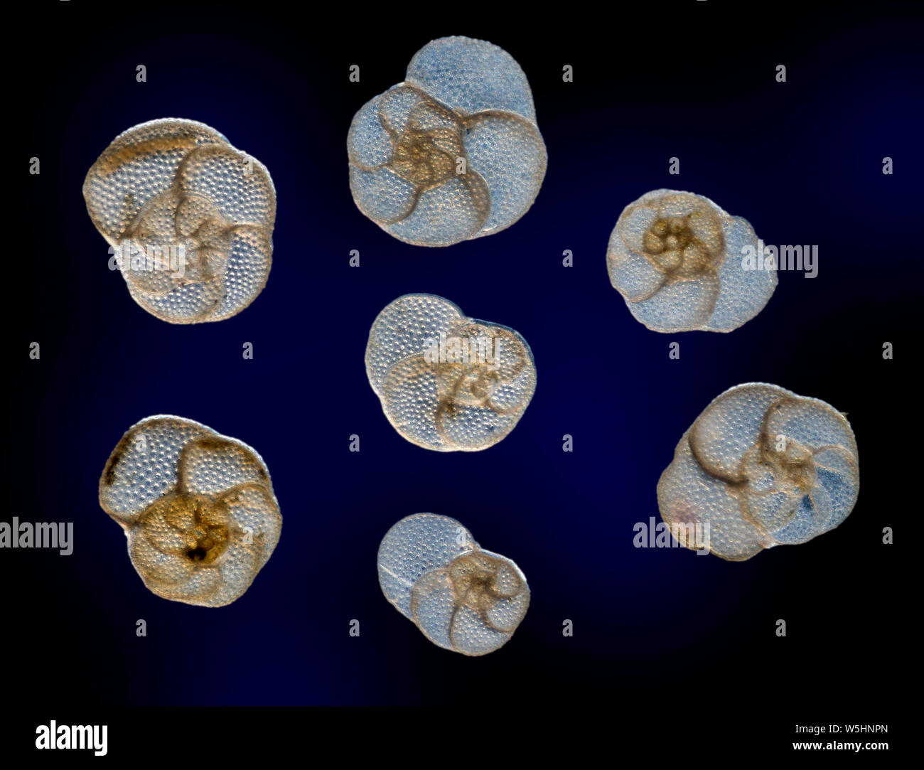 Foraminiferen, Rosalina globularis, Sai Wan, Hong Kong, South China Sea Stockfoto